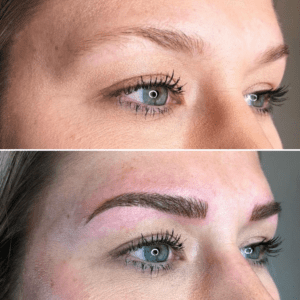 Microblading Treatment Before and After