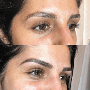 Microblading before and after na derm