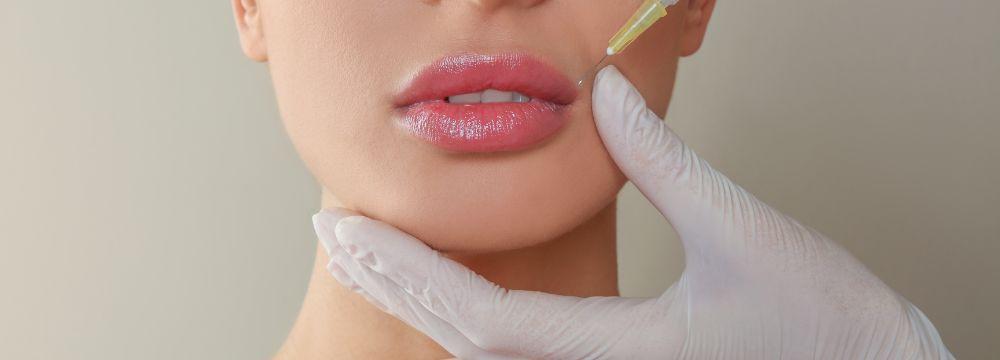 Woman receiving lip filler on top lip whose face is held with white glove