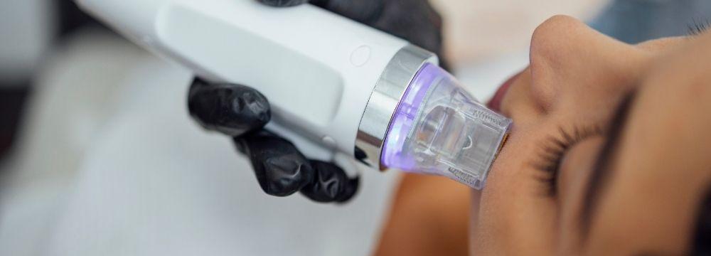 Woman receiving micro needling treatment under eye by doctor with black glove on