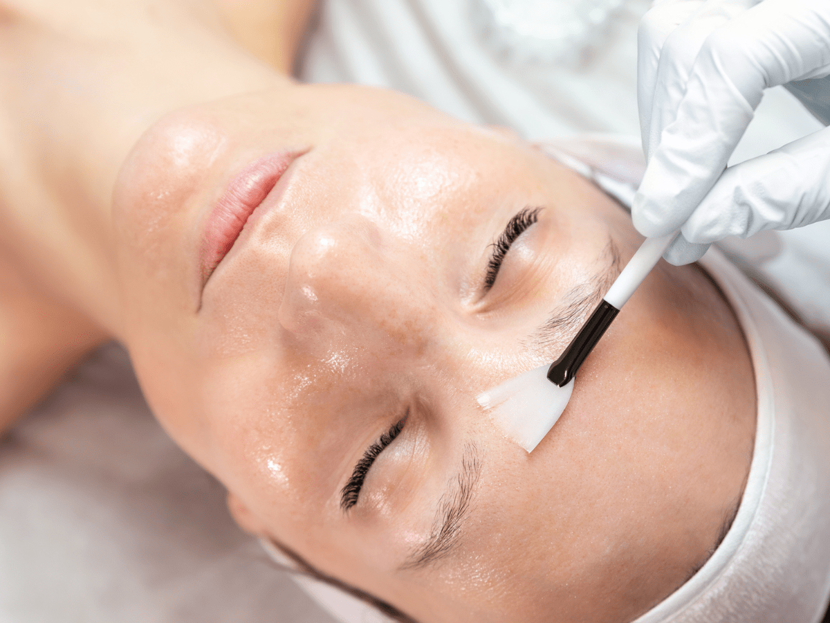 clear chemical peel treatment