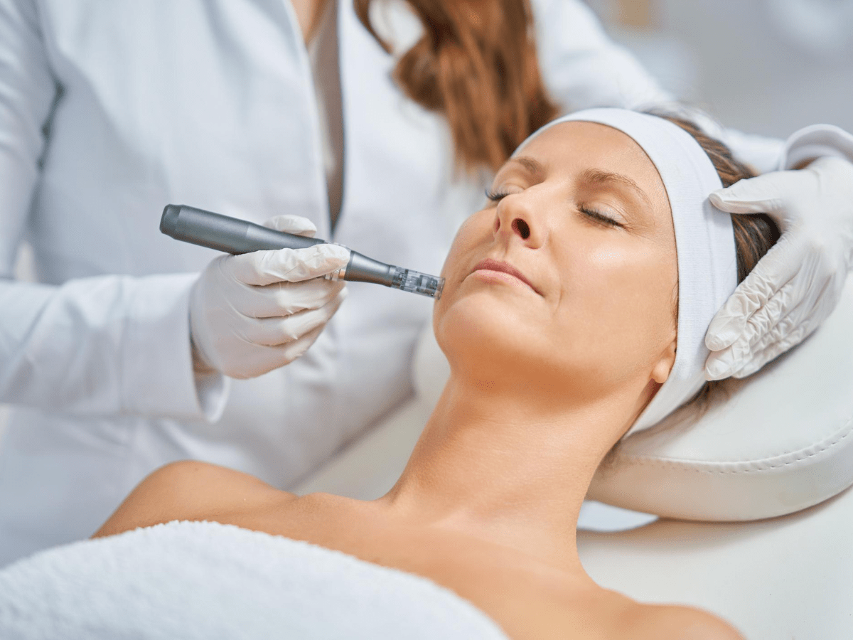 Microneedling - North Atlanta Dermatology